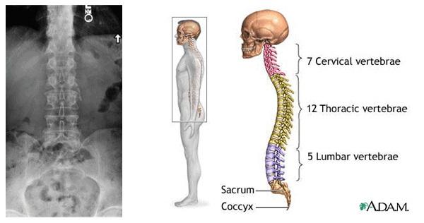 X-Rays | Byers Chiropractic